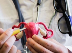 هل سمعتم عن مرض بطانة الرحم المهاجرة ؟